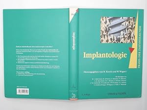 Implantologie. PDZ Band 13