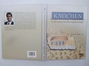 Knochen : Biologie, Gewinnung, Transplantation in der zahnärztlichen Implantologie. [Übers.: Hend...