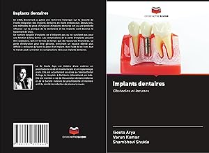 Bild des Verkufers fr Implants dentaires zum Verkauf von moluna