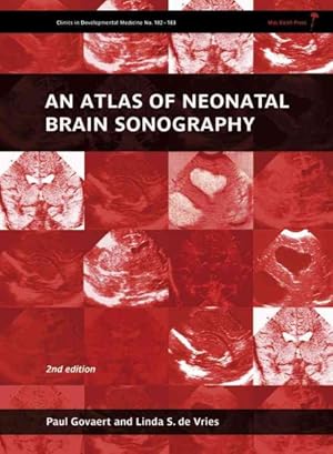 Seller image for Atlas of Neonatal Brain Sonography for sale by GreatBookPrices