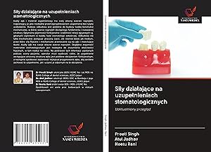 Seller image for Sily dzialajace na uzupelnieniach stomatologicznych for sale by moluna