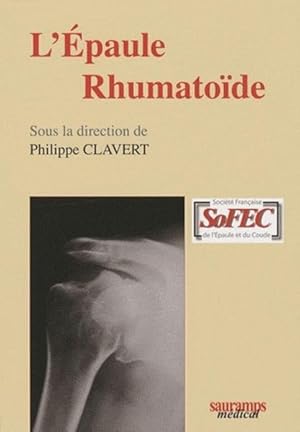 L'épaule rhumatoïde