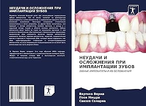 Seller image for NEUDAChI I OSLOZhNENIYa PRI IMPLANTACII ZUBOV for sale by moluna