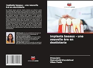 Bild des Verkufers fr Implants basaux - une nouvelle re en dentisterie zum Verkauf von moluna
