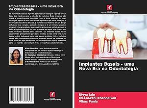 Bild des Verkufers fr Implantes Basais - uma Nova Era na Odontologia zum Verkauf von moluna