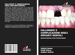 Seller image for FALLIMENTI E COMPLICAZIONI DEGLI IMPIANTI DENTALI for sale by moluna