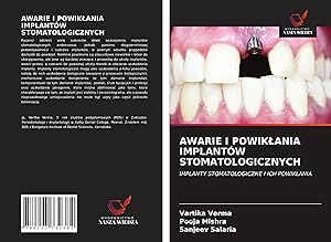 Seller image for AWARIE I POWIKLANIA IMPLANTW STOMATOLOGICZNYCH for sale by moluna
