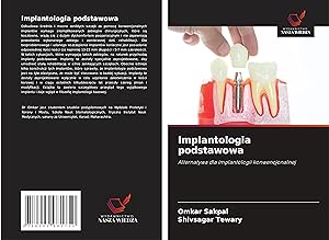 Seller image for Implantologia podstawowa for sale by moluna