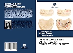 Seller image for HERSTELLUNG EINES ABNEHMBAREN TEILPROTHESENGERSTS for sale by moluna