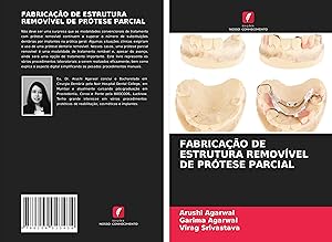 Seller image for FABRICAO DE ESTRUTURA REMOVVEL DE PRTESE PARCIAL for sale by moluna