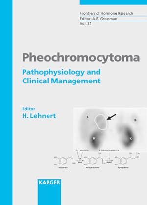 Pheochromocytoma : pathophysiology and clinical management ; 15 tables. (=Frontiers of hormone re...