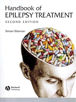 Handbook of Epilepsy Treatment: Forms, Causes and Therapy in children and adults