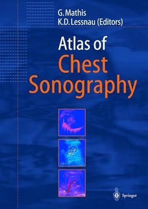 Image du vendeur pour Atlas of Chest Sonography. mis en vente par Antiquariat Thomas Haker GmbH & Co. KG