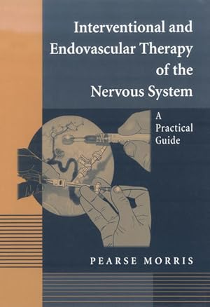 Seller image for Interventional and endovascular therapy of the nervous system : a practical guide. for sale by Antiquariat Thomas Haker GmbH & Co. KG