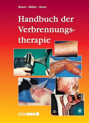 Handbuch der Verbrennungstherapie. Bruck . (Hrsg.). Autoren: A. Berger .