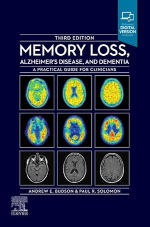 Bild des Verkufers fr Memory Loss, Alzheimer's Disease and Dementia : A Practical Guide for Clinicians zum Verkauf von AHA-BUCH GmbH