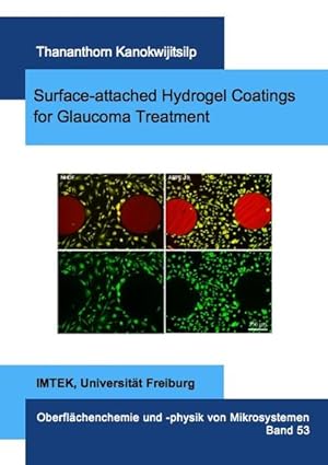Bild des Verkufers fr Surface-attached Hydrogel Coatings for Glaucoma Treatment. (Mikrosystemtechnik) zum Verkauf von Antiquariat Bookfarm