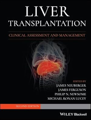Seller image for Liver Transplantation: Clinical Assessment and Management by Lucey, Michael R. [Hardcover ] for sale by booksXpress