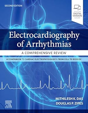 Imagen del vendedor de Electrocardiography of Arrhythmias: A Comprehensive Review by Das MD, Mithilesh Kumar, Zipes MD, Douglas P. [Paperback ] a la venta por booksXpress