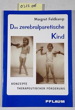 Das zerebralparetische Kind. Konzepte therapeutischer Förderung