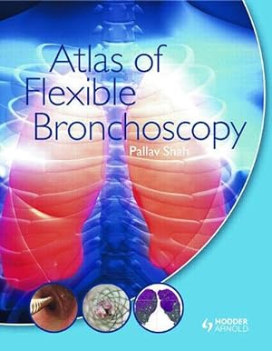 Seller image for Atlas of Flexible Bronchoscopy (Hardcover) for sale by Grand Eagle Retail