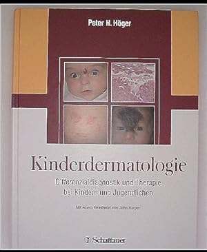 Kinderdermatologie: Differenzialdiagnose und Therapie bei Kindern und Jugendlichen