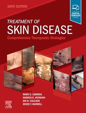 Seller image for Treatment of Skin Disease : Comprehensive Therapeutic Strategies for sale by GreatBookPrices