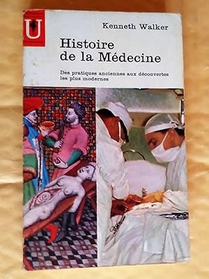 Histoire de la médecine; des pratiques anciennes aux découvertes les plus modernes