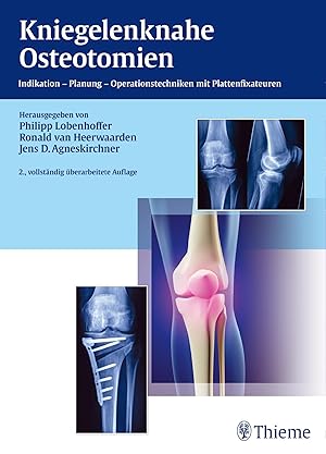 Bild des Verkufers fr Kniegelenknahe Osteotomien zum Verkauf von moluna