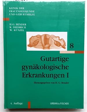 Bild des Verkufers fr Gutartige gynkologische Erkrankungen - I. zum Verkauf von BuchKunst-Usedom / Kunsthalle