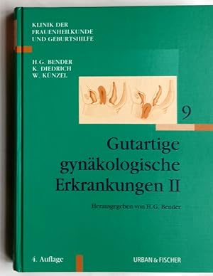 Seller image for Gutartige gynkologische Erkrankungen - II. for sale by BuchKunst-Usedom / Kunsthalle