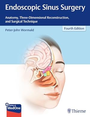 Immagine del venditore per Endoscopic Sinus Surgery : Anatomy, Three-Dimensional Reconstruction, and Surgical Technique venduto da GreatBookPricesUK