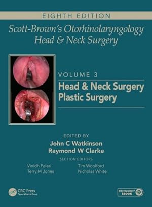 Immagine del venditore per Scott-Brown's Otorhinolaryngology and Head and Neck Surgery : Head and Neck Surgery, Plastic Surgery venduto da GreatBookPricesUK