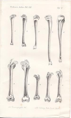 Röhrenknochen - normales und pathologisches Wachstum (4). Lithographie von Alb. Schütze, 21 x 13 ...