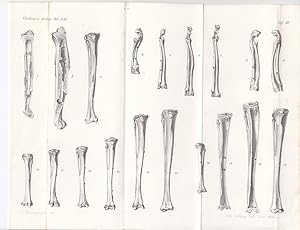 Röhrenknochen - normales und pathologisches Wachstum (2). Lithographie von Alb. Schütze, 21 x 26,...