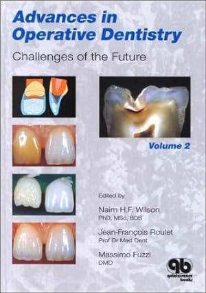 Image du vendeur pour Challenges of the Future (Vol II) (Advances in Operative Dentistry) mis en vente par WeBuyBooks