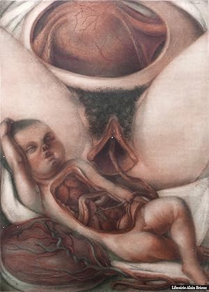 Image du vendeur pour Planche IX [Femme au travail de l'accouchement avec foetus] mis en vente par Librairie Alain Brieux