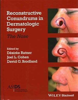 Seller image for Reconstructive Conundrums in Dermatologic Surgery : The Nose for sale by GreatBookPricesUK