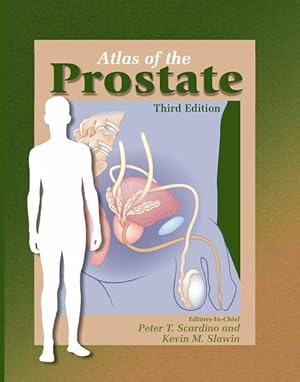 Seller image for Atlas of the Prostate. for sale by Antiquariat Thomas Haker GmbH & Co. KG