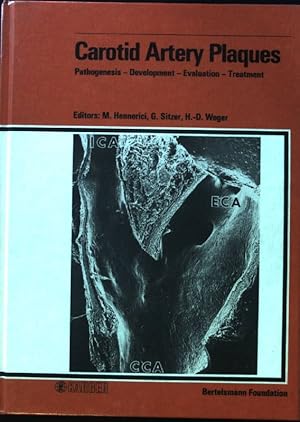 Bild des Verkufers fr Carotid artery plaques : pathogenesis - development - evaluation - treatment. Workshop on Carotid Artery Plaques. Organized by the Bertelsmann Foundation and the Dep. of Neurology, Univ. of Dsseldorf, Gtersloh, January 22 - 23, 1987. zum Verkauf von books4less (Versandantiquariat Petra Gros GmbH & Co. KG)