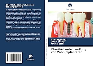 Seller image for Oberflaechenbehandlung von Zahnimplantaten for sale by moluna