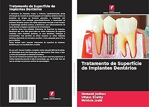 Seller image for Tratamento de Superfcie de Implantes Dentrios for sale by moluna