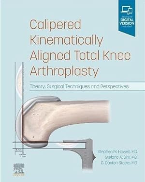 Seller image for Calipered Kinematically Aligned Total Knee Arthroplasty : Theory, Surgical Techniques and Perspectives for sale by GreatBookPrices