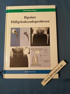 Bipolare Hüftgelenksendoprothesen. H.-G. Breyer (Hrsg.)