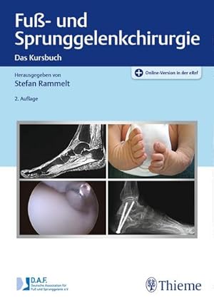 Bild des Verkufers fr Fu- und Sprunggelenkchirurgie : Das Kursbuch zum Verkauf von AHA-BUCH GmbH