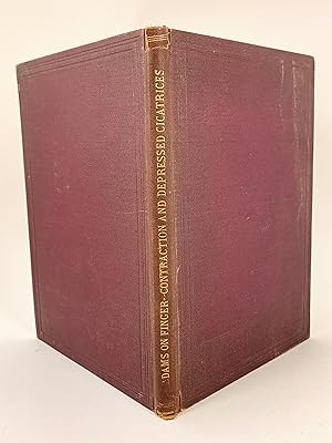 Observations on Contractions of the Fingers (Dupuytren's Contraction) and its Successful Treatmen...