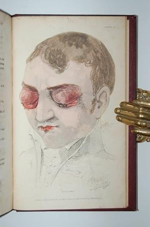 Immagine del venditore per A Practical Treatise on the Diseases of the Eye. venduto da Forest Books, ABA-ILAB