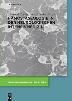 Bild des Verkufers fr Hmostaseologie in der neurologischen Intensivmedizin zum Verkauf von AHA-BUCH GmbH