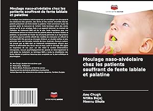 Bild des Verkufers fr Moulage naso-alvolaire chez les patients souffrant de fente labiale et palatine zum Verkauf von moluna
