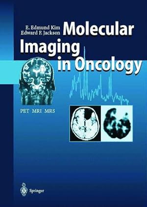 Seller image for Molecular Imaging in Oncology. PET, MRI, and MRS. for sale by Antiquariat Thomas Haker GmbH & Co. KG